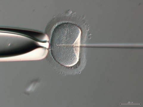 RC oocyte zona pellucida.jpg