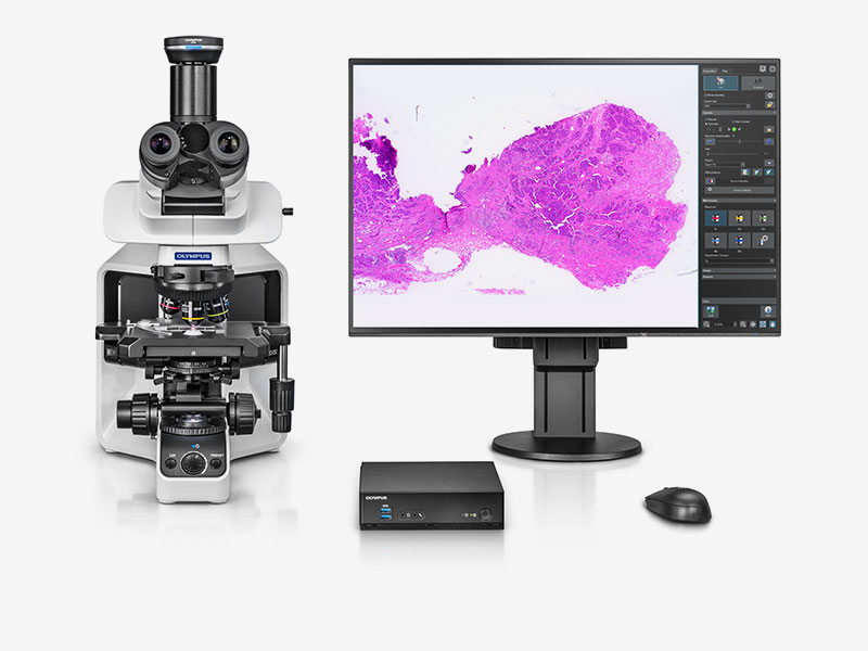 Microscope camera, Olympus DP28 w. DP2-AOU Stand-Alone Unit, 8.9 MPx, 1", Color